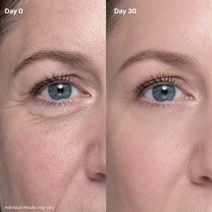 ⏳ Save 46% Today! 🔥 P7 Advanced Eye Renewal Cream 👁️✨